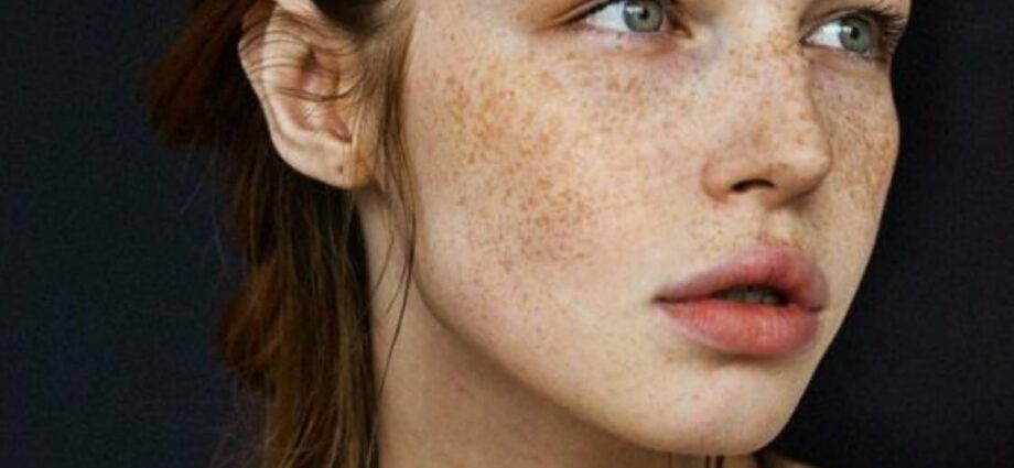 20 photos proving you need shiny freckles too