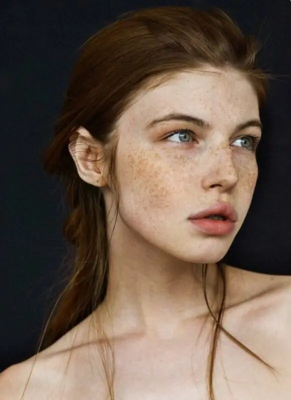 20 photos proving you need shiny freckles too