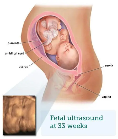 33 weeks pregnant: what happens to the baby, mother, childbirth, fetus, baby