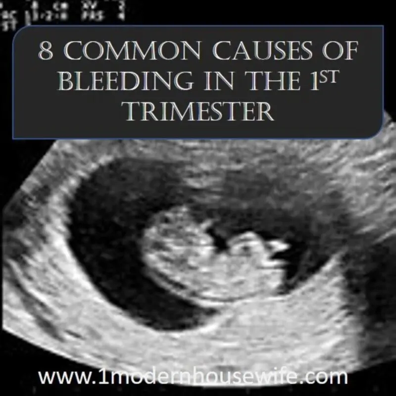 4 weeks pregnant: what happens from conception, ultrasound, brown discharge