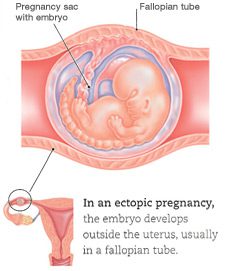 4th week of pregnancy (6 weeks)