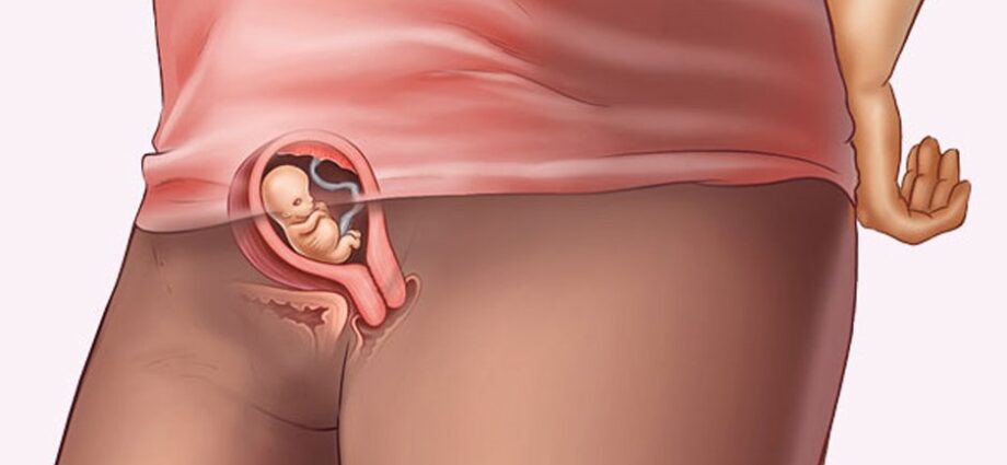 7 week of pregnancy: what happens from conception, stomach ache, discharge