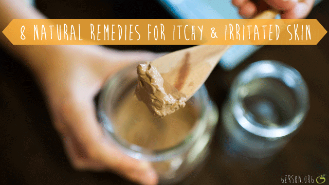 8 natural remedies to fight itching