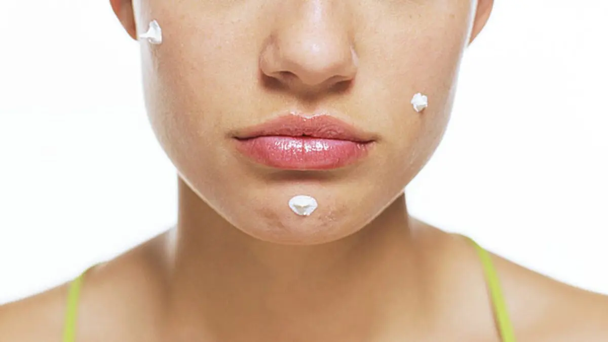 8 Popular Ways To Fight Acne You Should Not Repeat: Your Doctor&#8217;s Tips