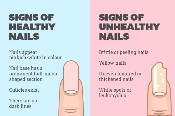 8 tips for healthy nails