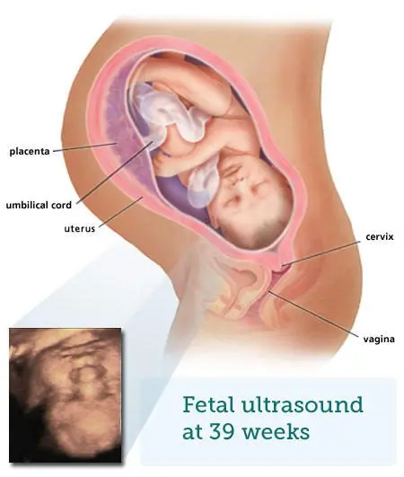 9 month pregnant