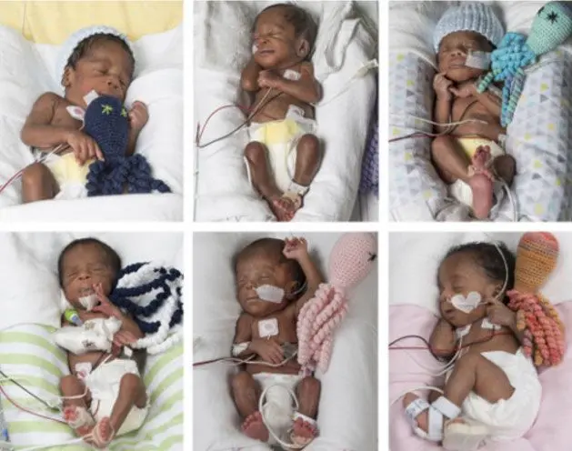 A 17-year-old woman tried to get pregnant and gave birth to six twins