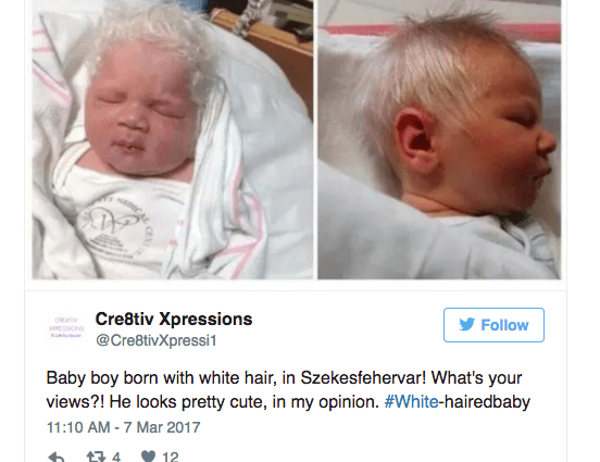 A child with white hair was born in Hungary