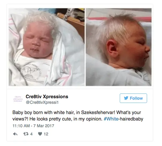 A child with white hair was born in Hungary