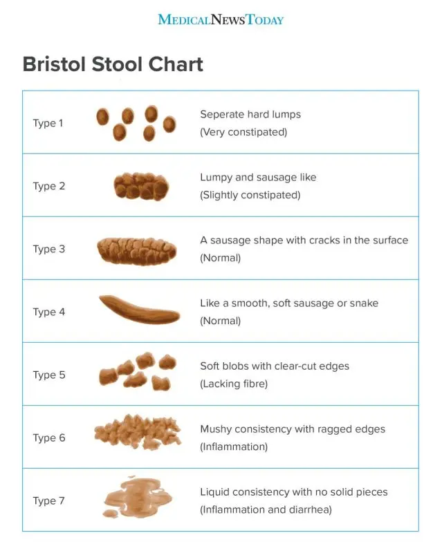 Abnormal stools