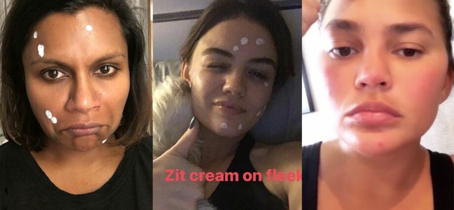 Acne and post-acne &#8211; stars with imperfect skin