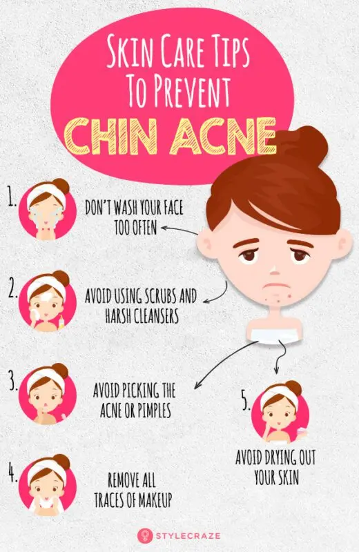 Acne on the chin: causes and treatment. Video