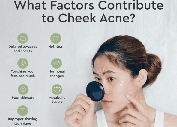 Acne on the face: how to get rid of quickly? Video