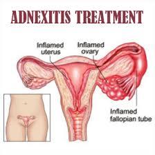 Adnexitis and pregnancy: how to cure adnexitis in early pregnancy