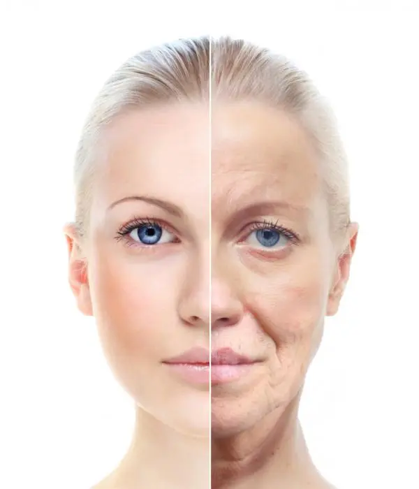 Aging skin &#8211; Our doctor&#8217;s opinion