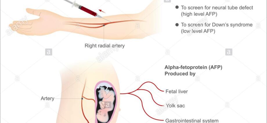 Análise de alfa-fetoproteína