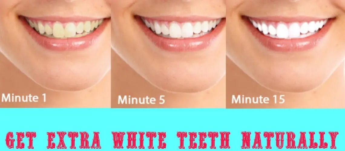 An effective way to whiten teeth without a dentist, and what doctors think about it