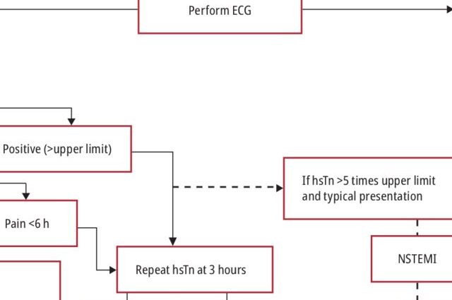 Angina in a pregnant woman, consequences; what can pregnant women with angina