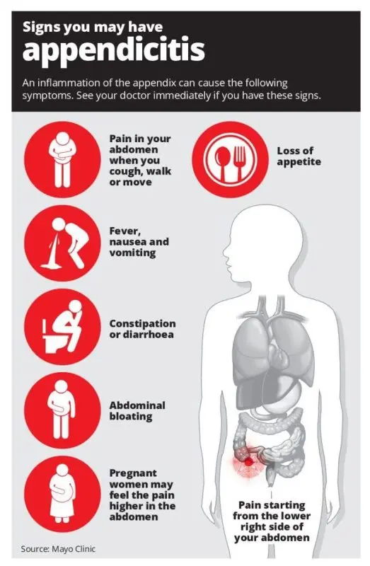 Appendicitis &#8211; Our doctor&#8217;s opinion