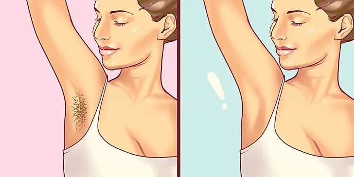 Armpit hair removal: how to avoid irritated armpits?