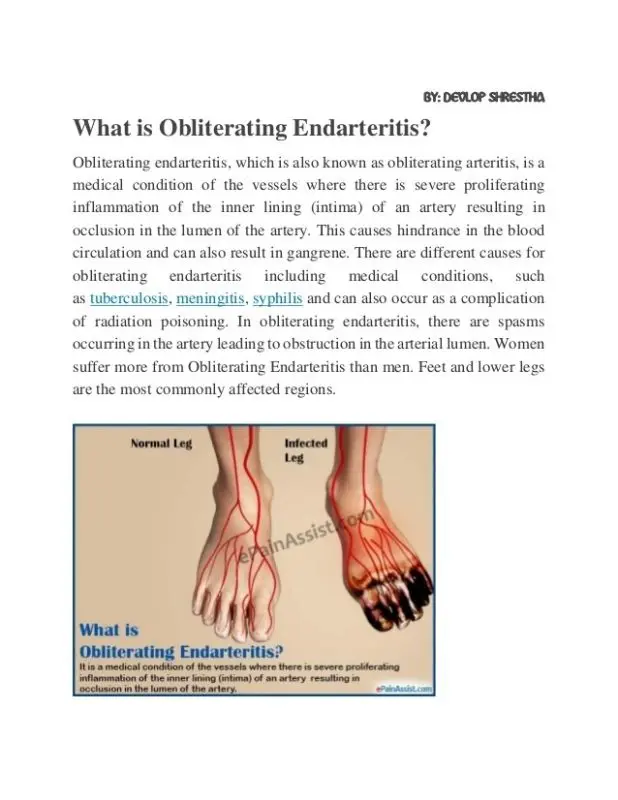 Arteritis obliterans of the lower extremities (PADI)