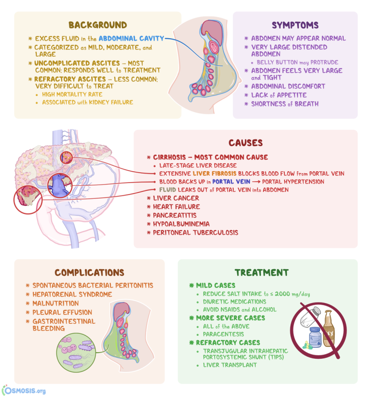 ascites-p-iny-a-l-ba-zdrav-j-dlo-v-m-m-okol