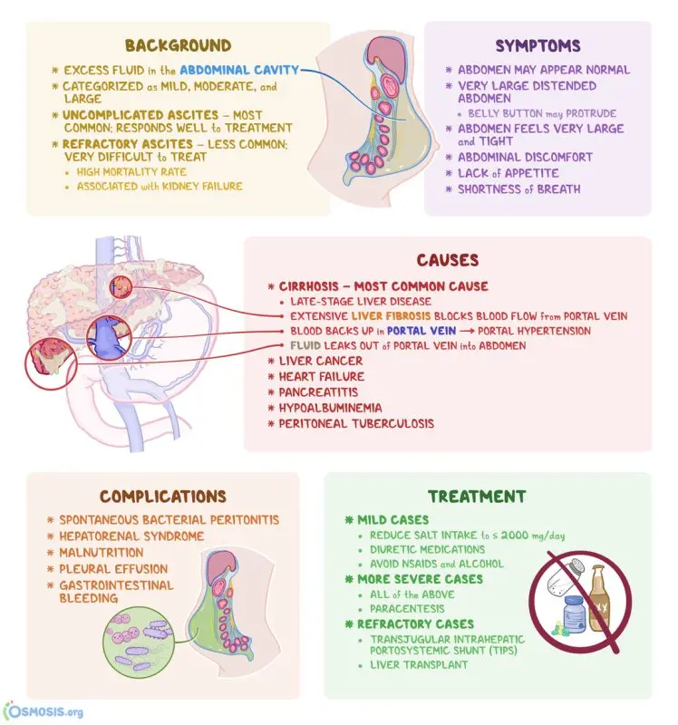 Ascites: causes and treatments