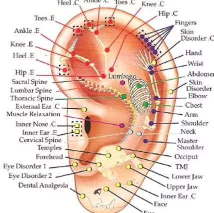 Auriculotherapy