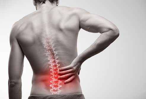 Sırt ağrısı: Sırt ağrısı nereden geliyor?