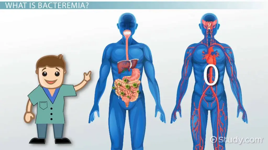 Bacteremia: definition, causes and symptoms