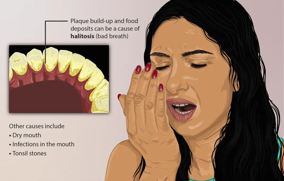 Bad breath: all you need to know about halitosis