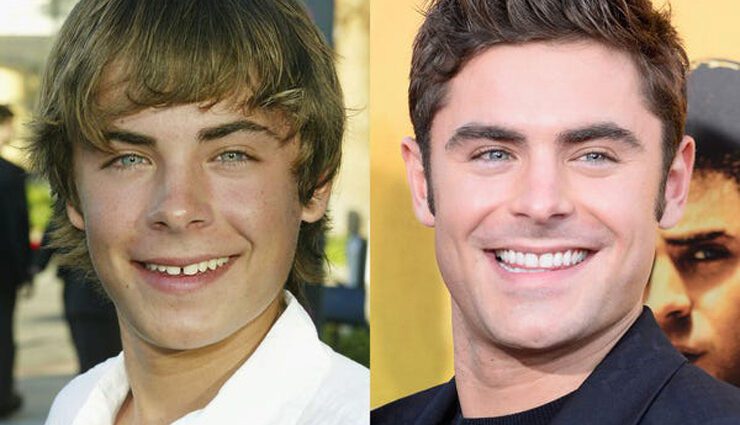 Bad teeth of stars: before and after &#8211; photo