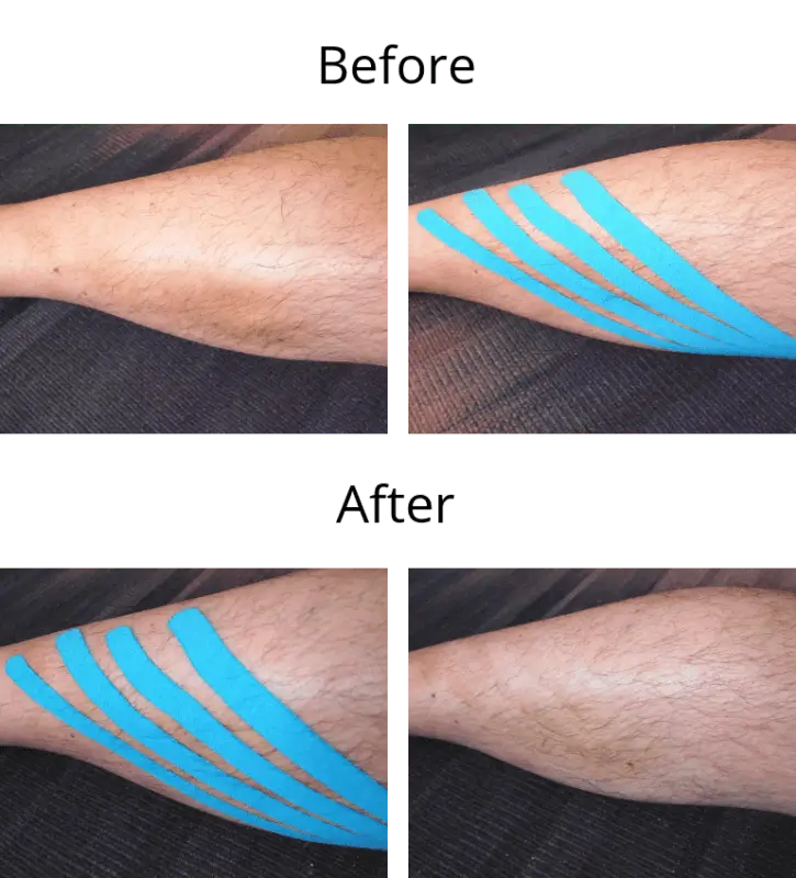 Before and after taping