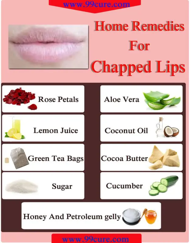 Best Remedies for Dry and Chapped Lips: The Editor&#8217;s Choice Wday.ru