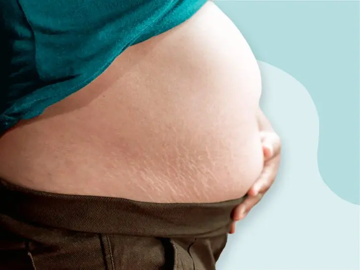 Big belly during pregnancy, causes