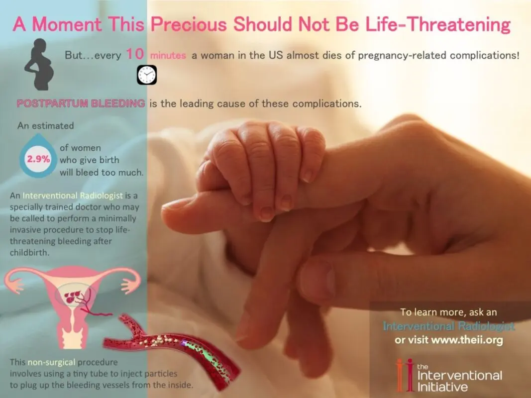 Bleeding during childbirth: complications