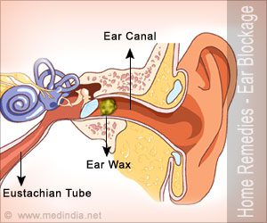 Blocks ears with a runny nose, what to do when ears are blocked from a runny nose