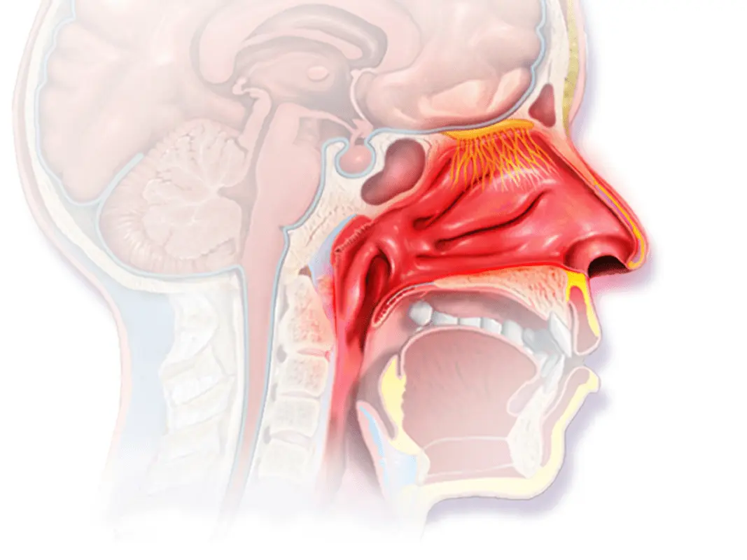 Blood from the nose during pregnancy