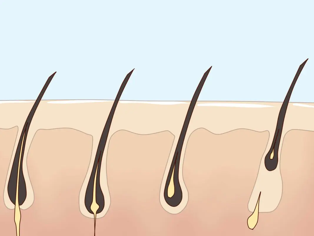 Body hair: how to get rid of? Hair Removal Videos