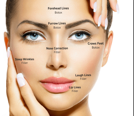 Botox injections for the face: expert