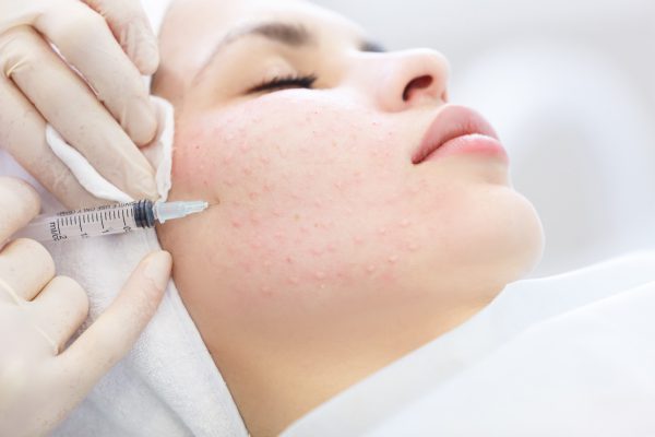 Botox injections or injection mesotherapy: which is better?