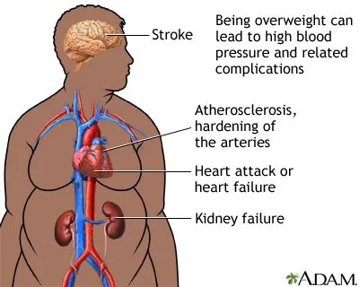 Brainworkers tend to be overweight