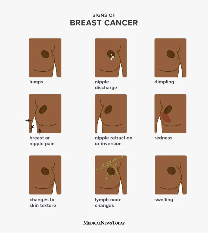 Breast examination: signs of normal