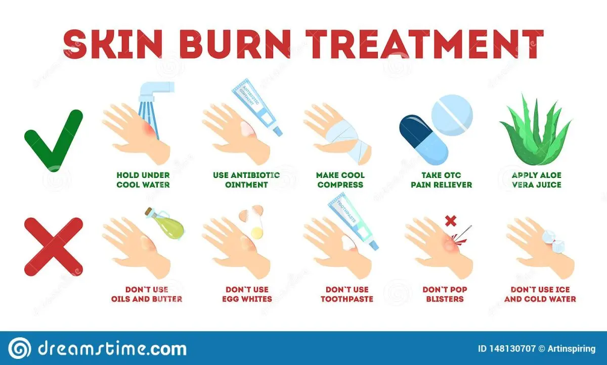 Burns: the first aid to be given