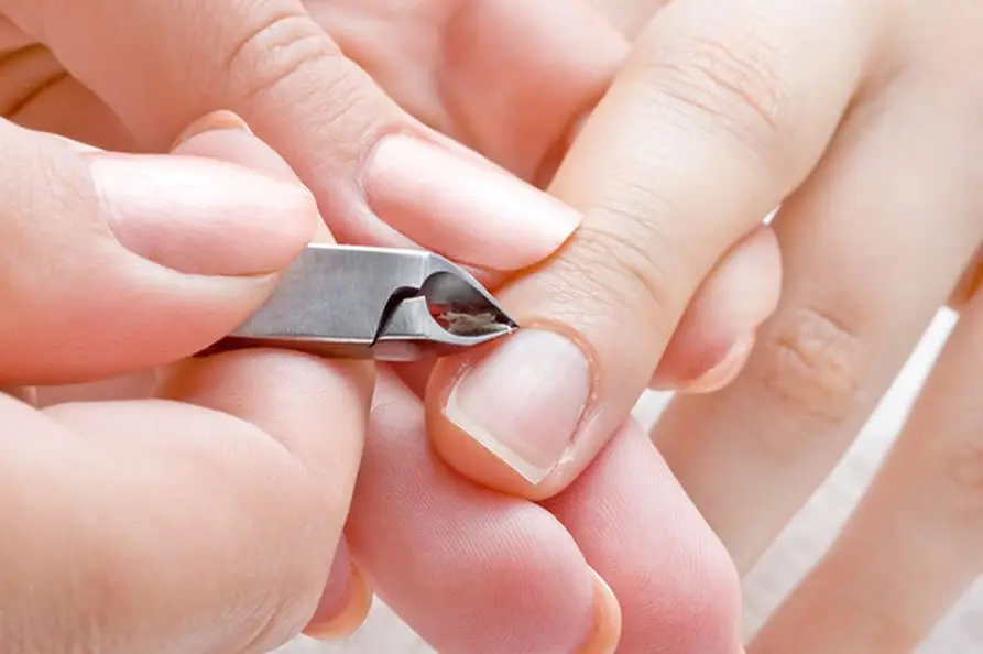 Burrs on the fingers: how to get rid of. Video