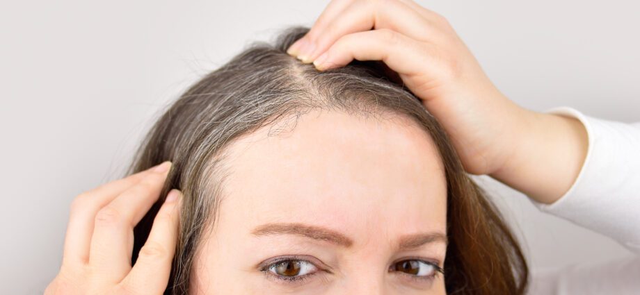 Můžeme zabránit vzniku šedivých vlasů?