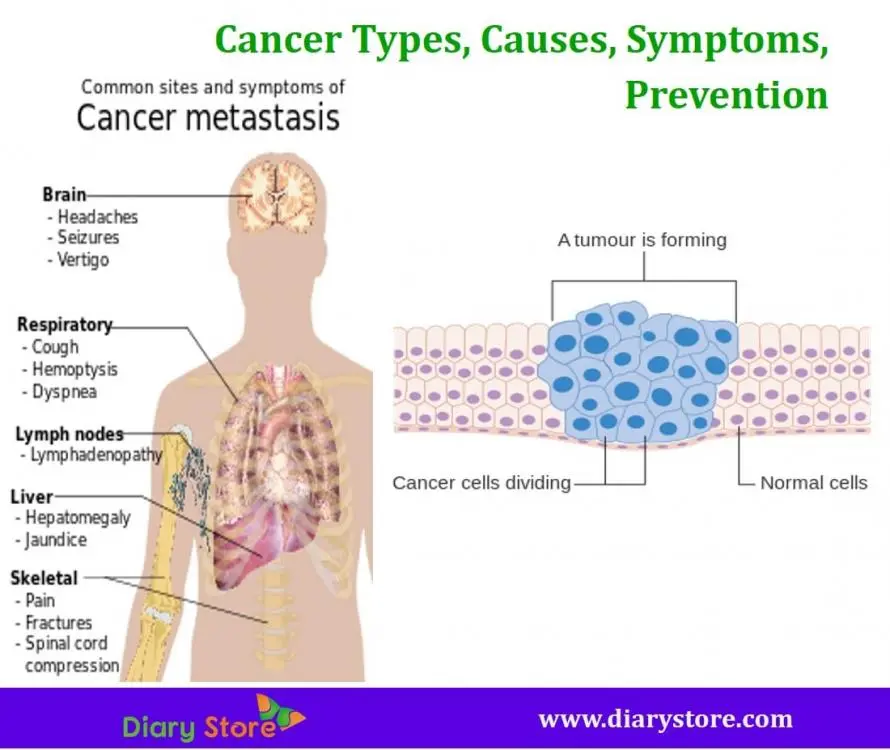 Cancer symptoms and causes, prevention