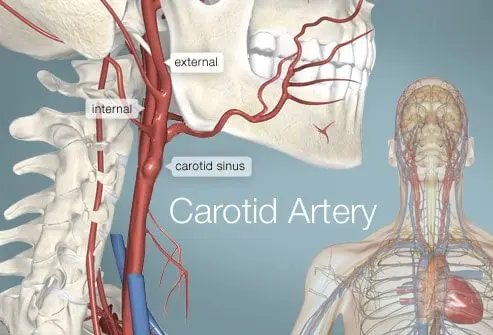 Carotid