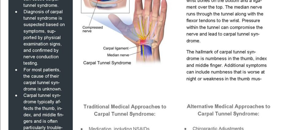 Carpal tunnel syndrome: mga pantulong na diskarte