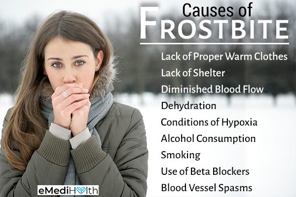 Causes and treatments of frostbite